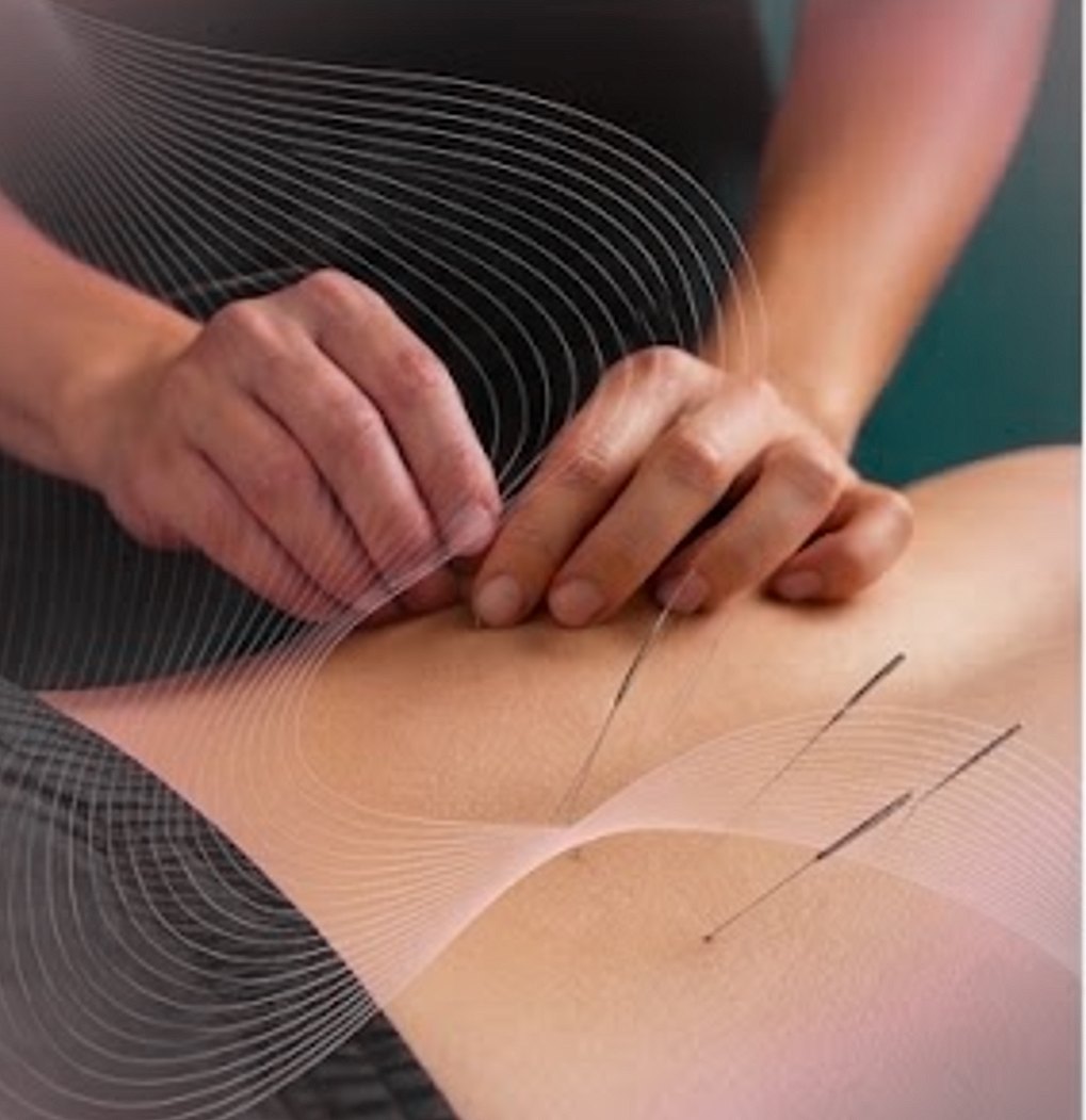 Close-up of a clinician's hands during a specialist physiotherapy treatment.